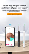 WaxWand - Wax Elimination Otoscope
